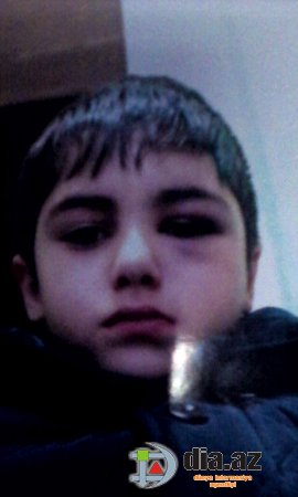 Bakıda orta mətəbdə daha bir dəhşət: 18 saylı məktəbin müəllimləri şagirdi ölümünə tərk etdilər Bakıda orta mətəbdə daha bir dəhşət: 18 saylı məktəbin müəllimləri şagirdi ölümünə tərk etdilər