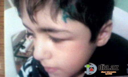 Bakıda orta mətəbdə daha bir dəhşət: 18 saylı məktəbin müəllimləri şagirdi ölümünə tərk etdilər Bakıda orta mətəbdə daha bir dəhşət: 18 saylı məktəbin müəllimləri şagirdi ölümünə tərk etdilər