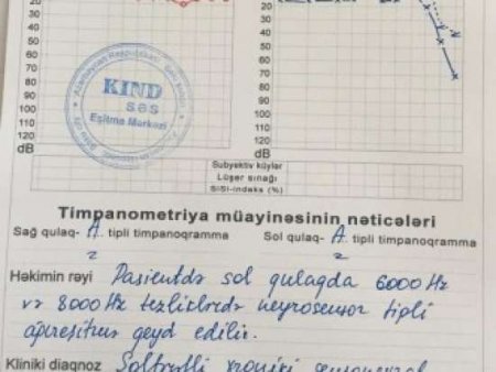 "KİND SƏS" eşitmə mərkəzində fırıldaq "KİND SƏS" eşitmə mərkəzində fırıldaq