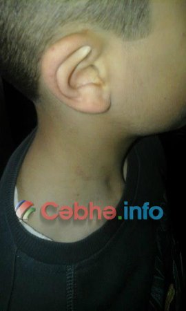 Bakı məktəbində OLAY: Bakı məktəbində OLAY:
