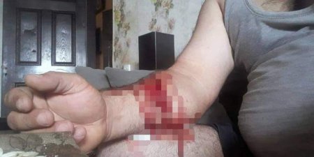 “Yelo” bank şəhid qardaşını intihara çatdırdı, damarlarını doğradı “Yelo” bank şəhid qardaşını intihara çatdırdı, damarlarını doğradı