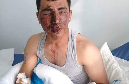 Sahil Babayevin nazirliyi daha bir Qazini intihar həddinə çatdırıb Sahil Babayevin nazirliyi daha bir Qazini intihar həddinə çatdırıb