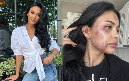 Model Razi Əliyeva sevgilisi Ziya tərəfindən DÖYÜLDÜ Model Razi Əliyeva sevgilisi Ziya tərəfindən DÖYÜLDÜ