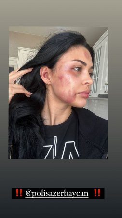 Razinin sevgilisi açıqlama yaydı Razinin sevgilisi açıqlama yaydı