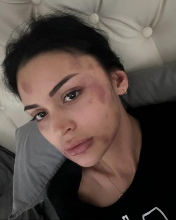 Sevgilisi Razinin başına hansı oyunları açıb... Sevgilisi Razinin başına hansı oyunları açıb...
