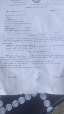 “Dövlətimdən pensiya istəyirəm, düşmürsə, onda məni işlə təmin etsinlər"