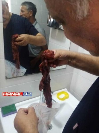 XƏSTƏXANA DEYİL... QƏSSABXANADIR... XƏSTƏXANA DEYİL... QƏSSABXANADIR...