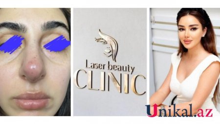 “Laser Beauty Clinic” tam bir QƏSSABXANA kimi işləyir...
