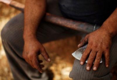 Bakıda baltalanan şəxs əməliyyat masasında öldü Bakıda baltalanan şəxs əməliyyat masasında öldü
