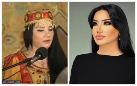 Əməkdar artist plastik əməliyyatla yanaqlarını kiçiltdi Əməkdar artist plastik əməliyyatla yanaqlarını kiçiltdi